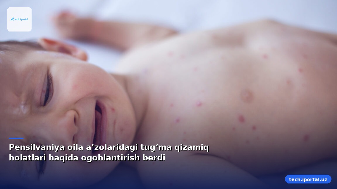 Pensilvaniya oila aʼzolaridagi tugʻma qizamiq holatlari haqida ogohlantirish berdi