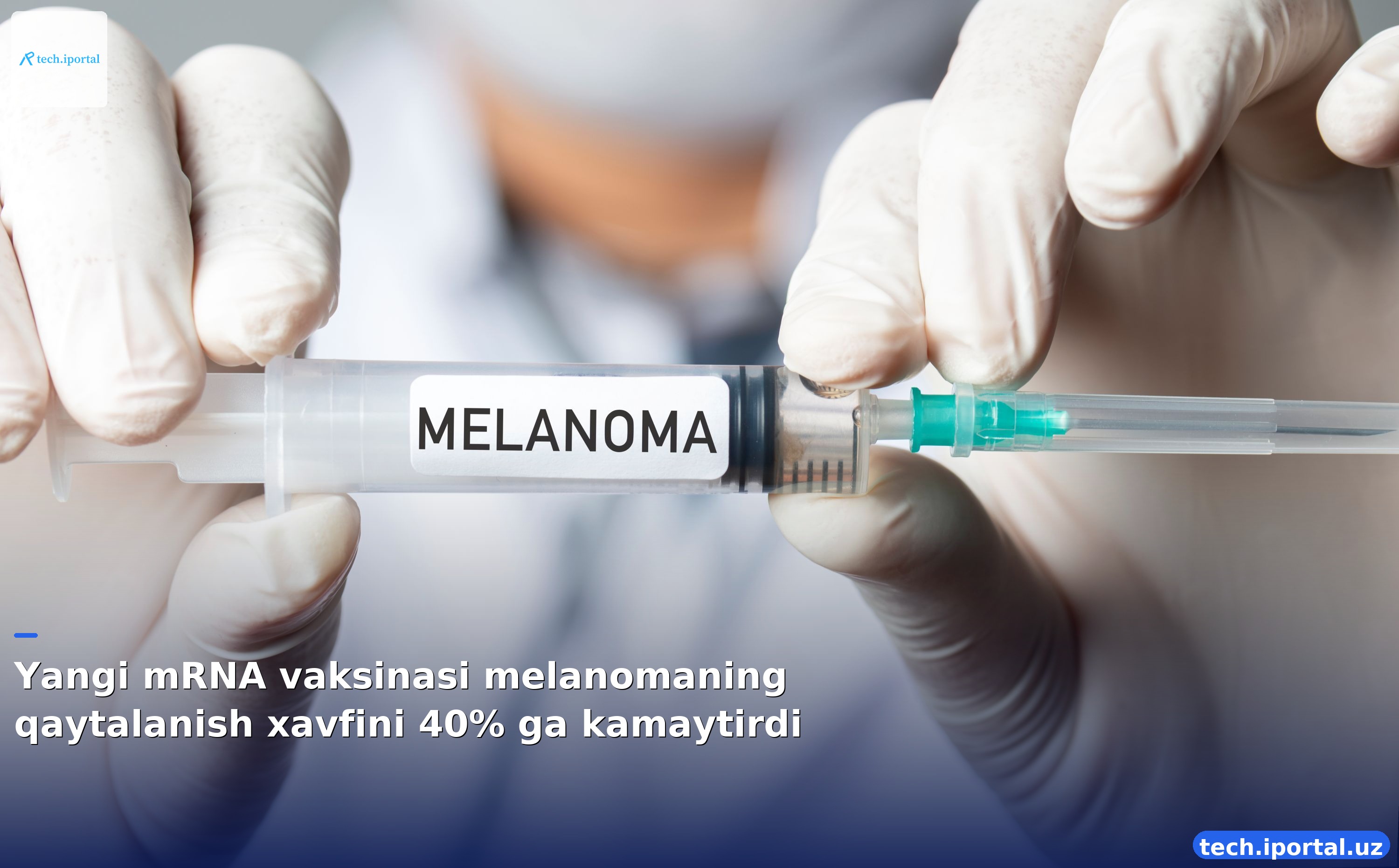 Yangi mRNA vaksinasi melanomaning qaytalanish xavfini 40% ga kamaytirdi